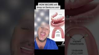 𝙃𝙤𝙬 𝙨𝙚𝙘𝙪𝙧𝙚 𝙬𝙞𝙡𝙡 𝙎𝙣𝙖𝙥 𝙞𝙣 𝘿𝙚𝙣𝙩𝙪𝙧𝙚𝙨 𝙗𝙚  Say Goodbye to Denture Discomfort SnapIn Dentures Unveiled [upl. by Eydnarb]