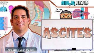 Ascites  Clinical Medicine [upl. by Niatsirhc223]