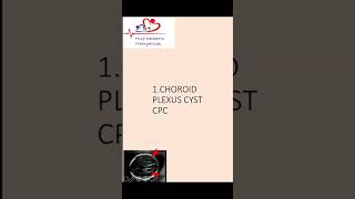 Choroid plexus cyst  Antenatal scan  Downs syndrome choroidplexuscyst [upl. by Arihsat]