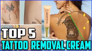 Top 5 Best Tattoo Removal Cream to Buy in 2020 [upl. by Bealle]