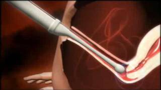 3D animation of how IVF works [upl. by Anyad7]