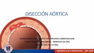 DISECCIÓN AÓRTICA  Manejo básico del paciente con patología cardiovascular [upl. by Anahpos565]