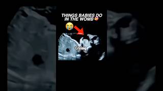 Things babies do in the womb ultrasound pregnancy baby cutebaby womenshealth [upl. by Nrubliw618]