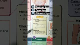 🔥 3 Signs of Appendicitis in 60 SECONDS Psoas Obturator Rovsing [upl. by Giovanna]