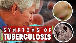 What is tuberculosis  symptoms of TB in all types and stages [upl. by Enileqcaj]