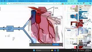 CABG Surgery Hindi [upl. by Aekal]