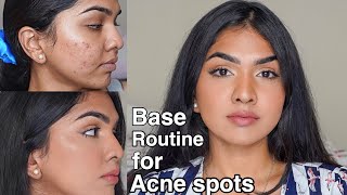 Flawless base routine for acne prone skin  acne pigmentation [upl. by Perle514]