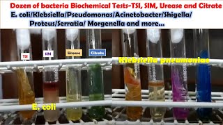 Various Bacteria Biochemical Tests E coli KlebsiellaPseudomonasAcinetobacterProteusMongenella [upl. by Welles828]