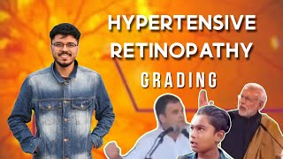 Hypertensive Retinopathy Grading  Ophthalmology  Retinal Disorders  NEETPG  INICET  FMGE [upl. by Egoreg]