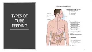 Enteral Feeding [upl. by Bullock696]