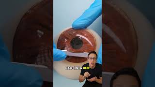 Corrigindo Miopia 👨‍⚕️👓 medicina medico oftalmologia curiosidades curiosidademedicina saude [upl. by Cullen668]