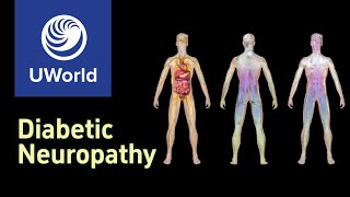 Diabetic Neuropathy  Pathophysiology Signs Symptoms  USMLE UWorld Step 1 Question MBBS MEDSTUDY [upl. by Hieronymus]