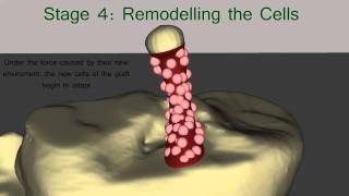 The Healing Process of the ACL Graft [upl. by Ominorej186]