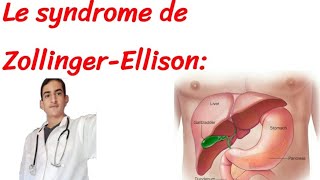 syndrome de zollinger ellison [upl. by Ruel]