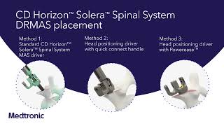 CD Horizon™ Solera™ Spinal System  Dual Rod MultiAxial Screw DRMAS amp Variable Angle Domino VAD [upl. by Chere632]