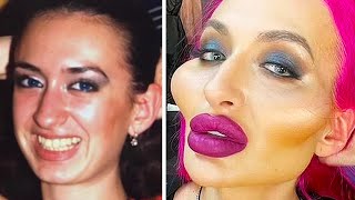 BOTCHED Celebrity Plastic Surgery That Made Them Unrecognizable [upl. by Shabbir]