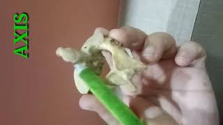 CERVICAL VERTEBRAE PART2  ATYPICAL CERVICAL VERTEBRAE  BY DR MITESH DAVE [upl. by Garvy]