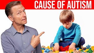 The REAL Cause of Autism Revealed Dr Berg Explains [upl. by Asaph]