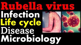 Rubella virus microbiology  infection pathology symptoms and replication cycle [upl. by Nesnah]