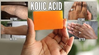 KOJIC ACID SOAP  How to lighten dark spots and get the best results [upl. by Durrett]