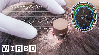 The Science Behind Elon Musk’s Neuralink Brain Chip  WIRED [upl. by Yerkovich]