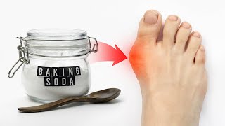 The 1 Remedy for Gout Attacks WORKS FAST  Dr Berg [upl. by Bilek518]