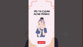 TIPS TO CLEAR ACNE MARKS ❤  glowup shorts trending tips [upl. by Blondell]