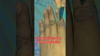 Back side wrinkles genius sign palmistry motivation amazingfacts viralvideo [upl. by Angelica]