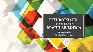 Presentation on Pseudophakic Cystoid Macular Edema By Dr Divya Alex  Giridhar Eye Institute [upl. by Hoo]