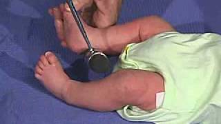 physical exam Newborn NormalReflexesDeep Tendon Reflexes [upl. by Rosemari]