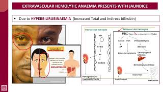 Hematology  2  U1L3  Intravascular and extravascular [upl. by Banquer]