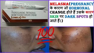 LOMELA CREAM का यूज कब और कैसे किया जाता हैचेहरे के दाग और धप्पे को हटाने वाली क्रीमMELASMA CREAM [upl. by Sundberg]