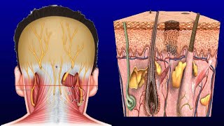 Swollen Occipital Lymph Node Causes And Treatment [upl. by Ranite]