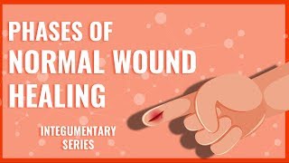 Wound Healing [upl. by Gabriell]