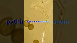 النطق الصحيح لفطر pythium debaryanum [upl. by Acinok225]