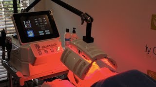 3D Skintech Facial Treatment  Skin Rejuvenation  Facials at The Body Clinic [upl. by Isus]