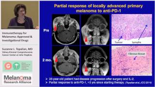 Immunotherapy for Melanoma Pt 2 Immune Checkpoints amp the Drugs That Block Them [upl. by Yekram]