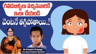 గవదబిళ్ళలు పోవాలంటే  How to Cure Mumps in Telugu  Mumps in Children  Treatment Range Hospital [upl. by Oisor]