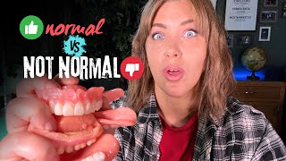 Dentures Whats Normal vs Not Normal [upl. by Anyrb188]