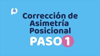 Corrección de Plagiocefalia  Paso 1 Diagnóstico [upl. by Annayt373]