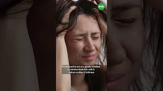 Proven Home Remedies To Cure Dandruff I OnlyMyHealth [upl. by Biondo697]