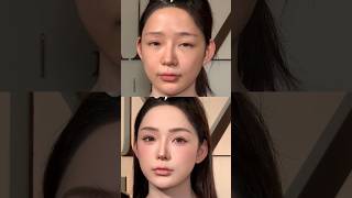 Quick Makeup Hacks to Hide Face Discoloration 💄✨ BeautyTips [upl. by Myrna]