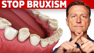 The Best 2 Remedies for Teeth Grinding Bruxism [upl. by Atlee]