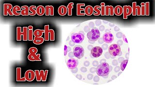 Reason of High Eosinophil  High Eosinophil causes [upl. by Lomaj862]