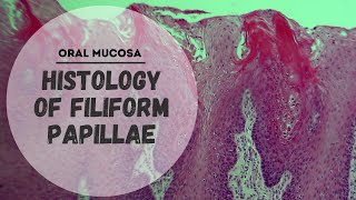 Histology of Specialized Mucosa  Filiform papillae [upl. by Philo]