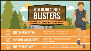 How To Treat Foot Blisters Like A Pro [upl. by Arde]