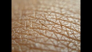 What Causes Skin to Wrinkle and What is Myofascia Release [upl. by Aitercul]