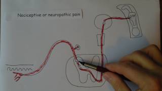 Neuropathic pain [upl. by Aisya]