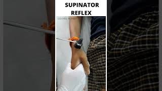 SUPINATOR REFLEX [upl. by Lehcer]