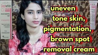 Depiwhite cream review  Skin lightening  pigmentation  acne spots  uneven skin  Fairness cream [upl. by Stu]